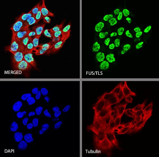 FUS/TLS Rabbit Polyclonal Antibody