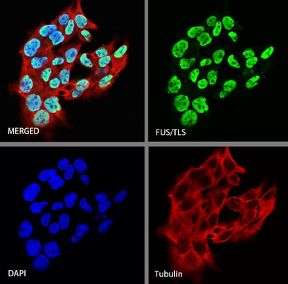 FUS/TLS Rabbit Polyclonal Antibody