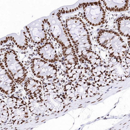 TAF15 Recombinant Rabbit mAb (S-1508-53)