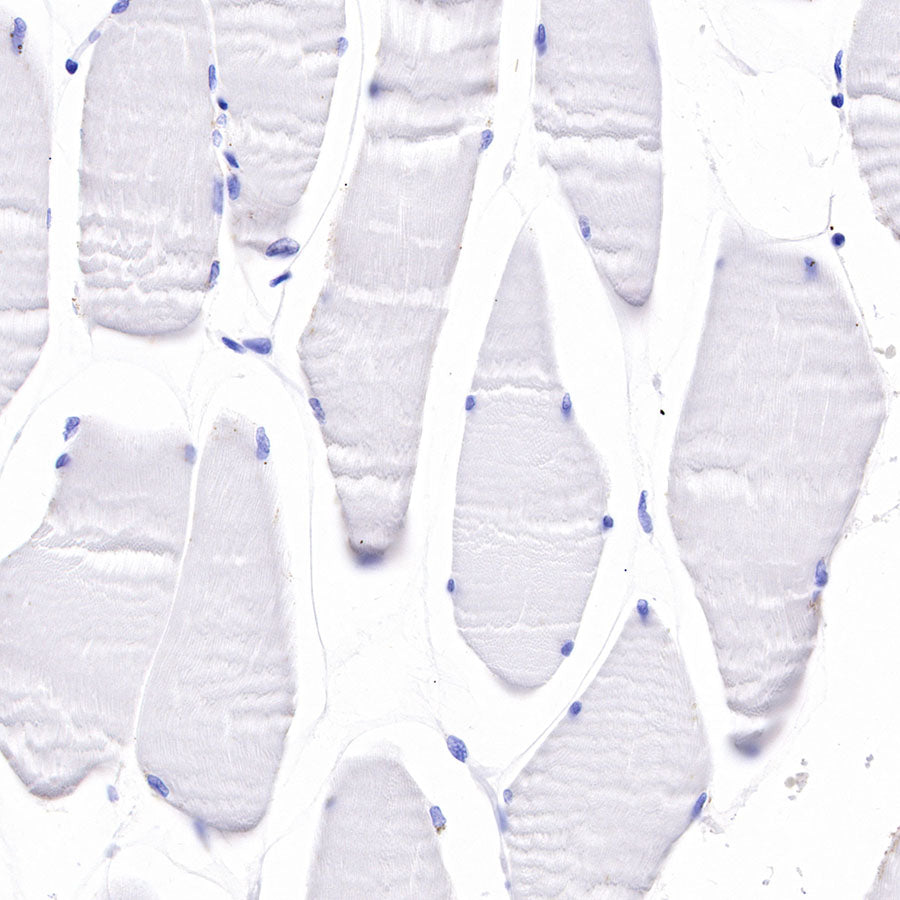 Myosin-11/SMMHC Recombinant Rabbit mAb,PBS Only (SDT-188-112)