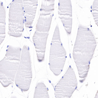 Myosin-11/SMMHC Recombinant Rabbit mAb,PBS Only (SDT-188-112)