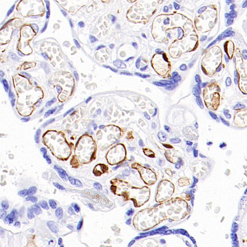 FABP4 Recombinant Rabbit mAb (S-1360-168)