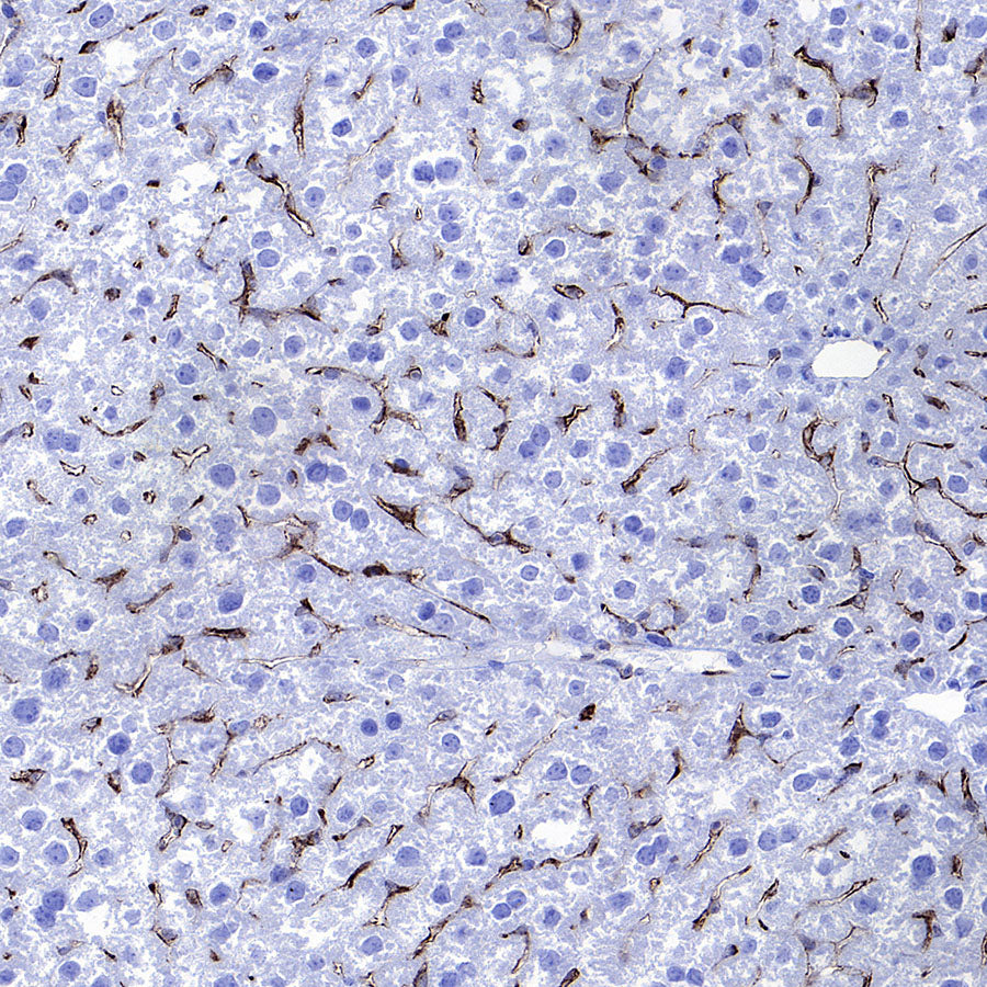 CD206 Recombinant Rabbit mAb (S-3477-27)