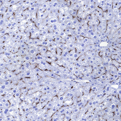 CD206 Recombinant Rabbit mAb (S-3477-27)