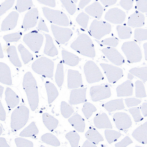 Keratin 16 Recombinant Rabbit mAb (S-R306)