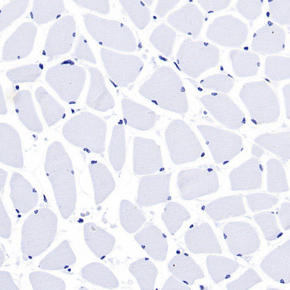 Keratin 16 Recombinant Rabbit mAb (S-R306)