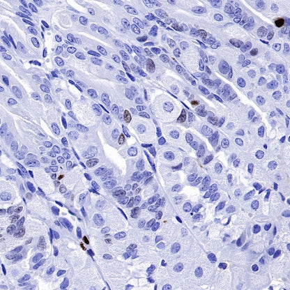 S-RMab® Ki67 Recombinant Rabbit mAb (SDT-R459)