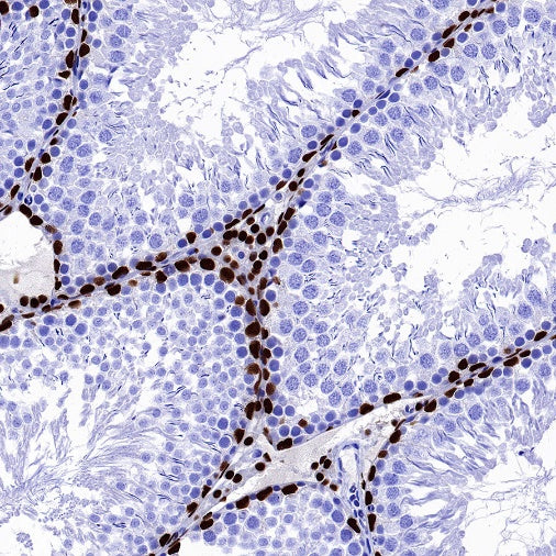 GATA4 Recombinant Rabbit mAb (S-1428-141)
