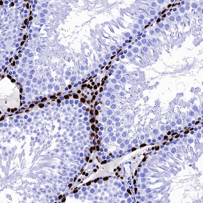 GATA4 Recombinant Rabbit mAb (S-1428-141)