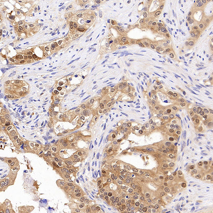Tug Recombinant Rabbit mAb (S-4377-21)