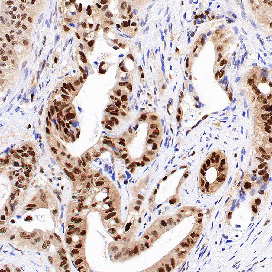 TBX18 Recombinant Rabbit mAb (S-4619-17)