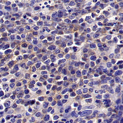 CD56 Recombinant Rabbit mAb (SDT-2427-1)