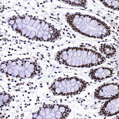 NuMA Recombinant Rabbit mAb (SDT-474-241)
