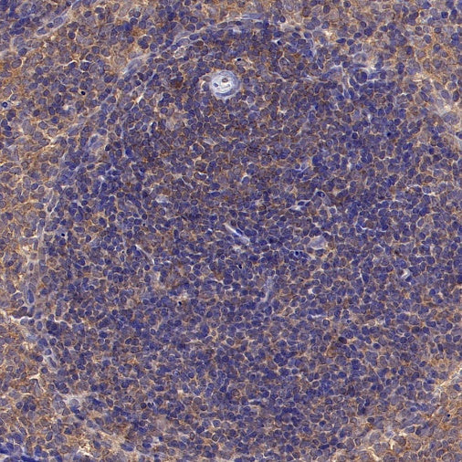 SMAD2 Recombinant Rabbit mAb (S-1420-20)