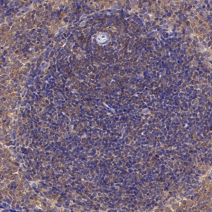 SMAD2 Recombinant Rabbit mAb (S-1420-20)