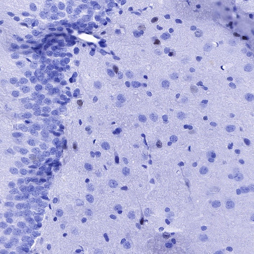 SOX1 Recombinant Rabbit mAb (S-R310)