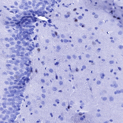 SOX1 Recombinant Rabbit mAb (S-R310)