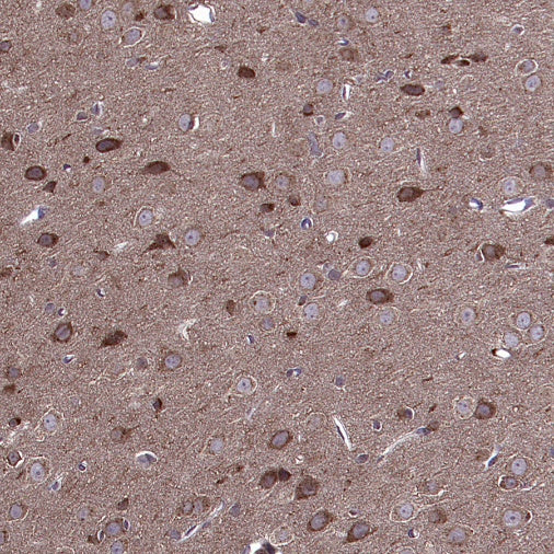 GABARAP Recombinant Rabbit mAb (S-2372-47)