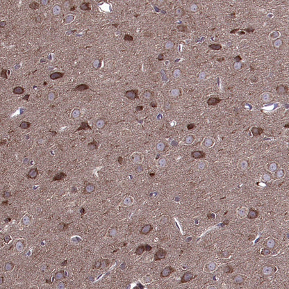 GABARAP Recombinant Rabbit mAb (S-2372-47)