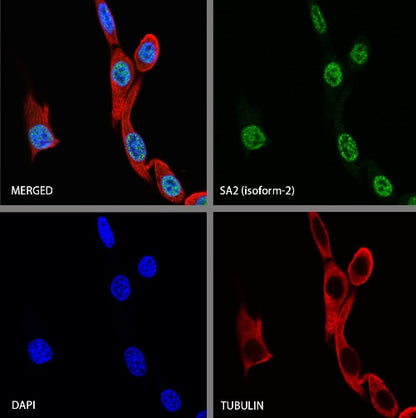 SA2 (isoform-2) Recombinant Rabbit mAb (S-1461-231)