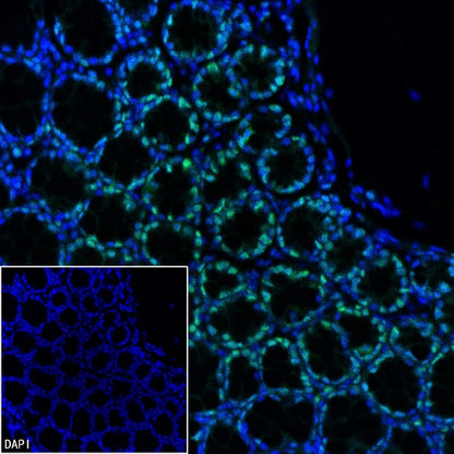 HAT1 Recombinant Rabbit mAb (S-2429-14)