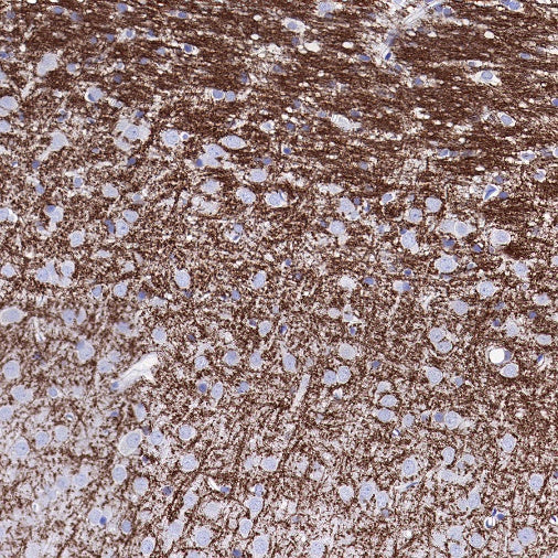 Myelin Oligodendrocyte Glycoprotein (MOG) Recombinant Rabbit mAb (S-1384-61)