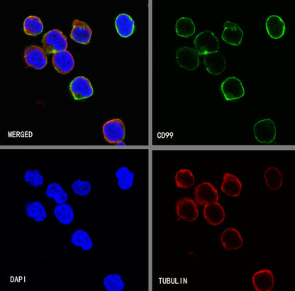 CD99 Recombinant Rabbit mAb (SDT-R122)