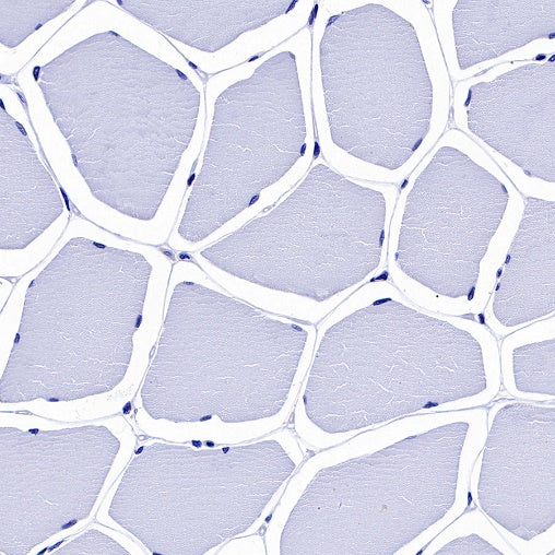 Cardiac Troponin I Recombinant Rabbit mAb (S-1352-28)
