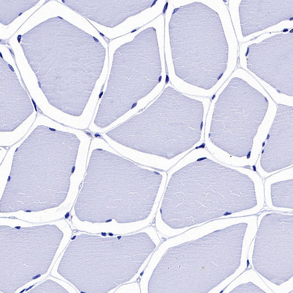 Cardiac Troponin I Recombinant Rabbit mAb (S-1352-28)