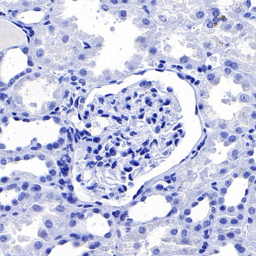 FABP7 Recombinant Rabbit mAb (S-762-41)
