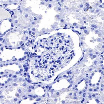 FABP7 Recombinant Rabbit mAb (S-762-41)