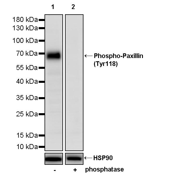 Phospho-Paxillin (Tyr118) Recombinant Rabbit mAb (S-4990)