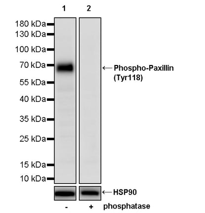 Phospho-Paxillin (Tyr118) Recombinant Rabbit mAb (S-4990)
