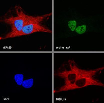 active YAP1 Recombinant Rabbit mAb (S-3261)