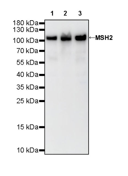 MSH2 Recombinant Rabbit mAb (SDT-037-20)