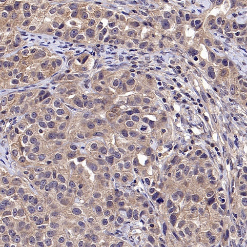 CK1α Recombinant Rabbit mAb (SDT-2884-60)