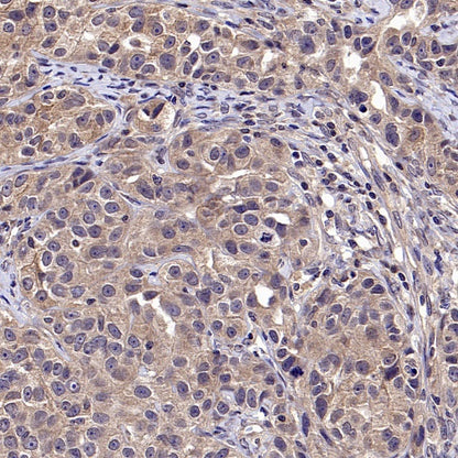 CK1α Recombinant Rabbit mAb (SDT-2884-60)