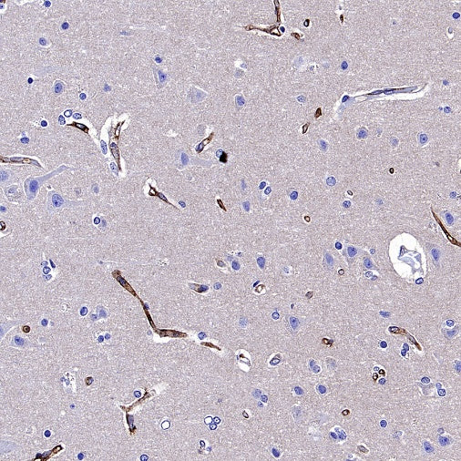 CA4 Recombinant Rabbit mAb (S-2339-24)