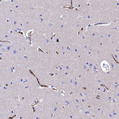 CA4 Recombinant Rabbit mAb (S-2339-24)