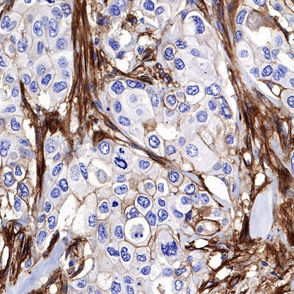 Integrin alpha 5 Recombinant Rabbit mAb (S-381-37)