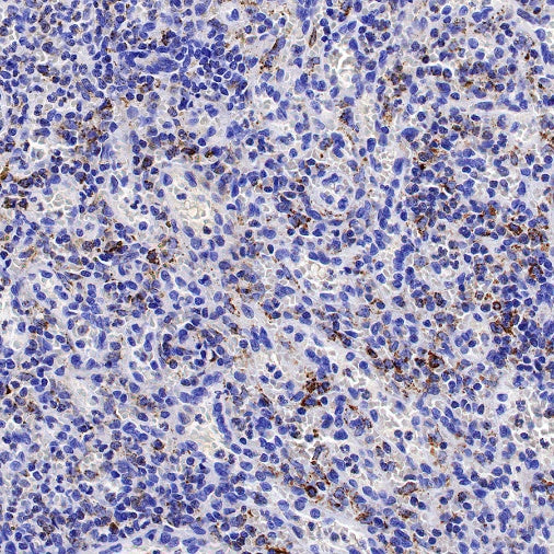 IDH2 Recombinant Rabbit mAb (S-1525-5)