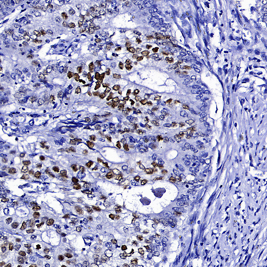 Cyclin E1 Recombinant Rabbit mAb (SDT-4375-29)