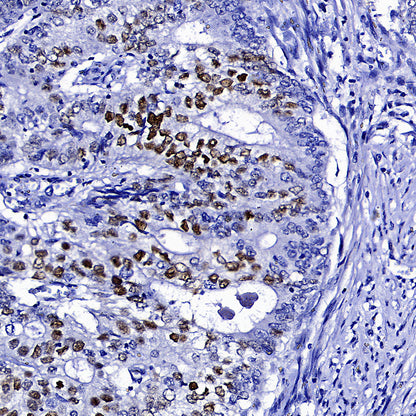 Cyclin E1 Recombinant Rabbit mAb (SDT-4375-29)