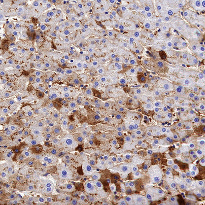 Citrate synthetase Recombinant Rabbit mAb (S-1708-56)