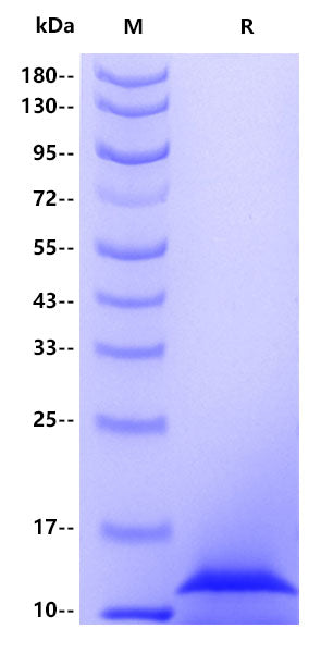Calprotectin（S100A8）His Tag Protein, Human