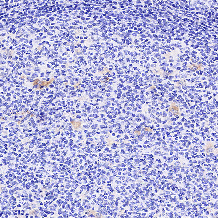 Tartrate Resistant Acid Phosphatase Recombinant Rabbit mAb (S-5960)