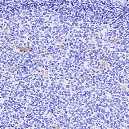 Tartrate Resistant Acid Phosphatase Recombinant Rabbit mAb (S-5960)