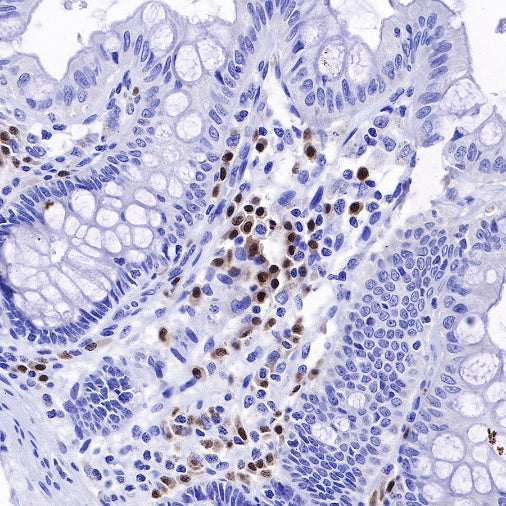IRF4 Recombinant Rabbit mAb (S-654-33)