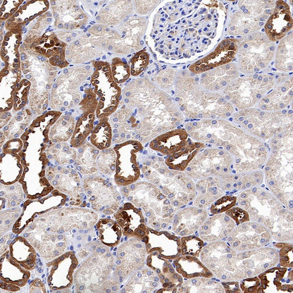 HPRT1 Rabbit Polyclonal Antibody