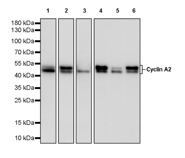 Cyclin A2 Recombinant Rabbit mAb (S-2554-2)